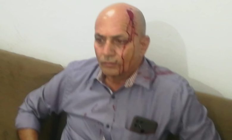 MP: भोपाल में बिल्डर की गुंडागर्दी, रजिस्ट्री कराने की जगह सर फोड़ा 1 IMG 20240609 WA0015