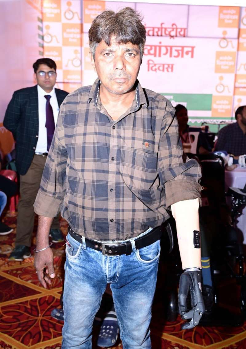 मोहन को जब मिला निःशुल्क कृत्रिम फंक्शनबेल हाथ तो खिल