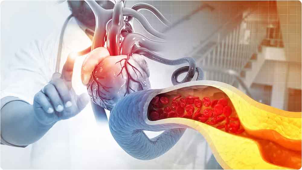 कोलेस्ट्रॉल बढ़ने से सिर्फ हृदय रोग ही नहीं इन गंभीर