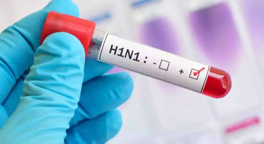 बदलते मौसम में फ्लू और वायरल इन्फेक्शन के मामलो में