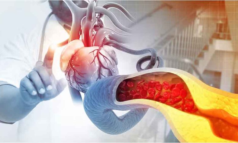 कोलेस्ट्रॉल बढ़ने से सिर्फ हृदय रोग ही नहीं इन गंभीर