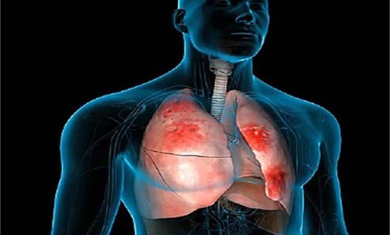 निमोनिया भी एक गंभीर बीमारी बन कर सामने आ रही