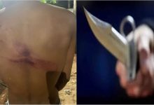 चाकू मारकर भाग रहे थे बदमाश गांव वालों ने पकड़कर