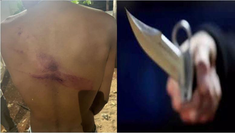 चाकू मारकर भाग रहे थे बदमाश गांव वालों ने पकड़कर