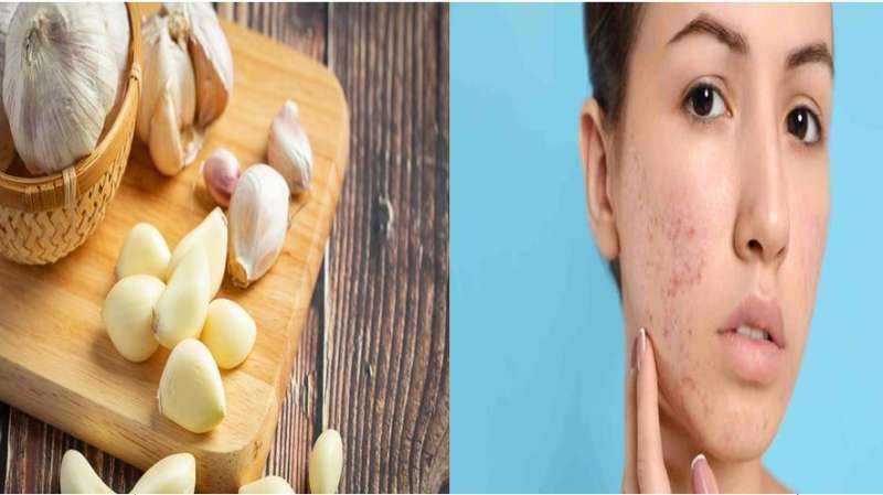लहसुन से निखरेगा चेहरा दाग धब्बों का दुश्मन है ये देसी