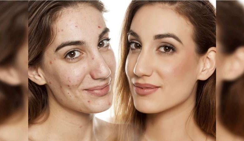 क्रीम नहीं, पत्तियां हैं असली स्किन केयर समाधान, जानें इस्तेमाल का तरीका 1 क्रीम नहीं पत्तियां हैं असली स्किन केयर समाधान जानें इस्तेमाल