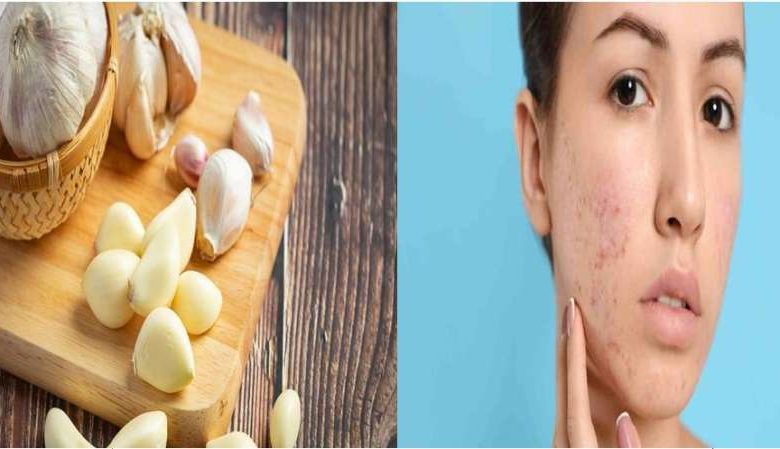 लहसुन से निखरेगा चेहरा दाग धब्बों का दुश्मन है ये देसी