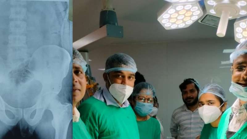 गुप्तांग के रास्ते पेट में पहुंची बोतल डॉक्टरों ने किया