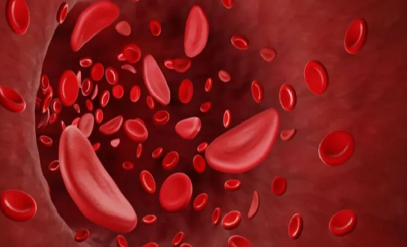 छत्तीसगढ़ में महिलाओं की सेहत पर खतरा एनीमिया के आंकड़े