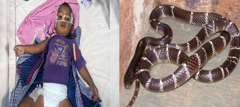 डॉक्टरों के संघर्ष से जीती जिंदगी तीन बार सांप के