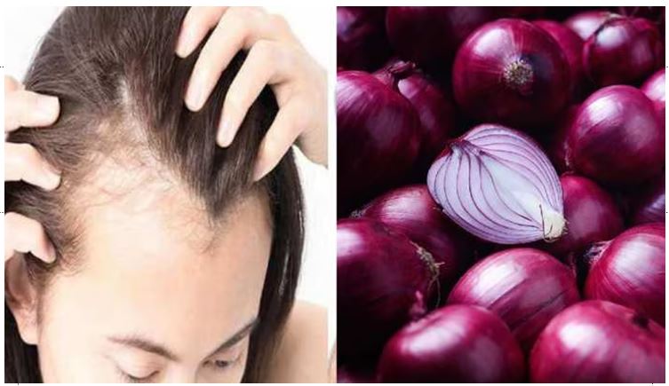लोहे के तवे पर भूने प्याज से करें हेयर ट्रीटमेंट