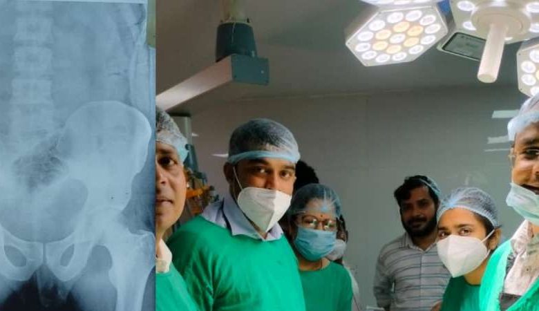 गुप्तांग के रास्ते पेट में पहुंची बोतल डॉक्टरों ने किया
