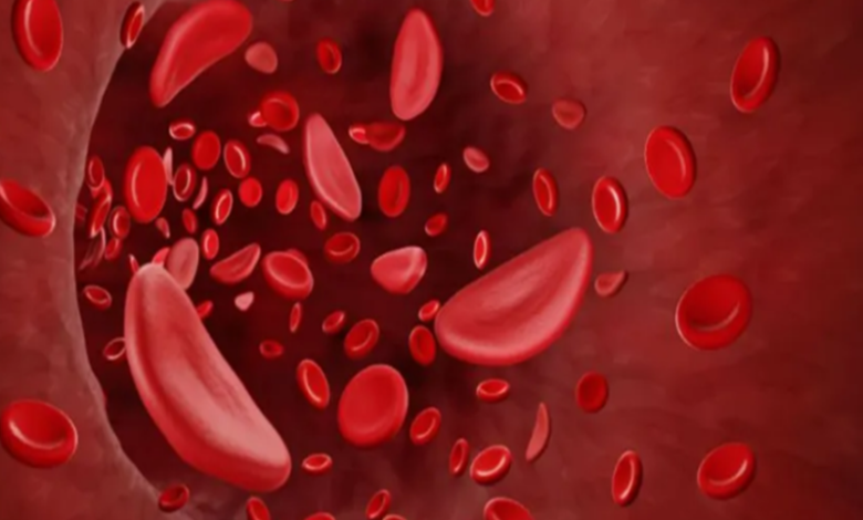 छत्तीसगढ़ में महिलाओं की सेहत पर खतरा एनीमिया के आंकड़े