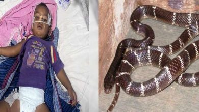 डॉक्टरों के संघर्ष से जीती जिंदगी तीन बार सांप के