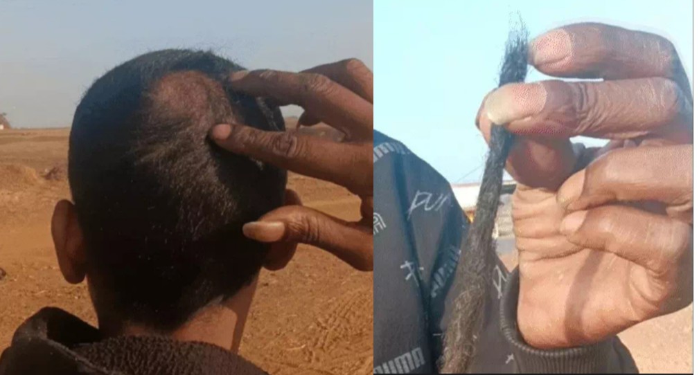 MP : तुम्हें चोटी रखने का कोई अधिकार नहीं.. कहकर 12 इंच लंबी चोटी उखाड़ी, रीवा में युवक बोला- सात साल से रखी थी, क्षेत्र में तनाव 6 Screenshot 20260111 154943.InShot28129